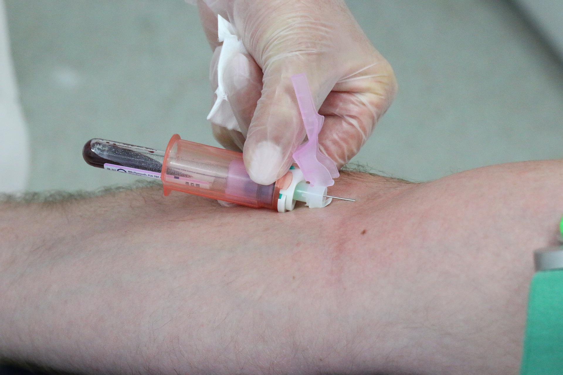 blood-draw-g37750e782_1920