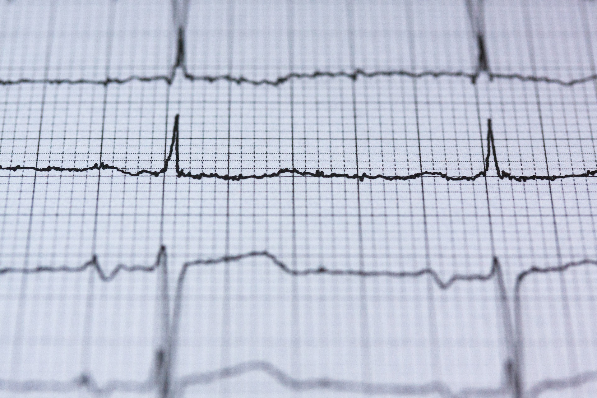 ecg-g070445bda_1920
