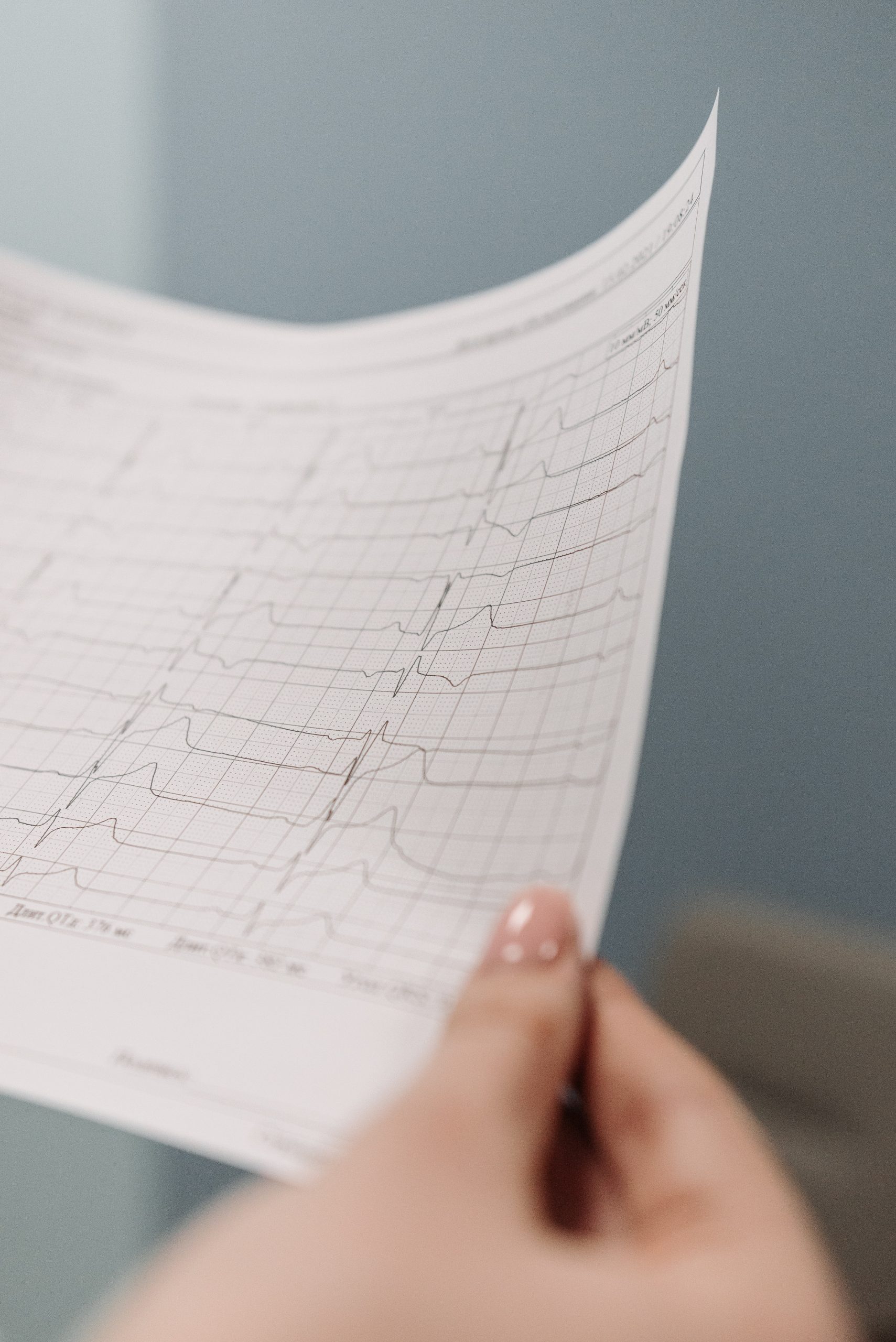 Électrocardiogramme en cours de réalisation